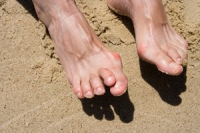 What Does Hammertoe Look Like?