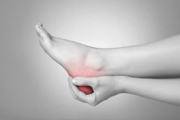 Baseball Players and Plantar Fasciitis