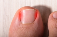 How to Trim Toenails