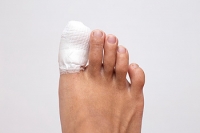 How Are Toe Fractures Treated?