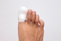 How Are Toe Fractures Treated?