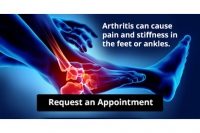 Arthritis Can Cause Pain in the Feet